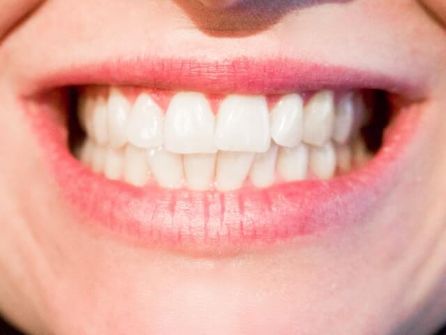 smiling white teeth