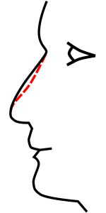 effect of plastic surgery