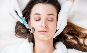 micro needling therapy