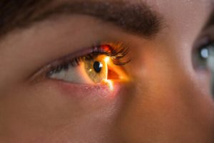 can laser eye surgery fix astigmatism check
