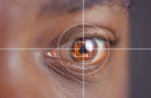 how long does laser eye surgery take procedure