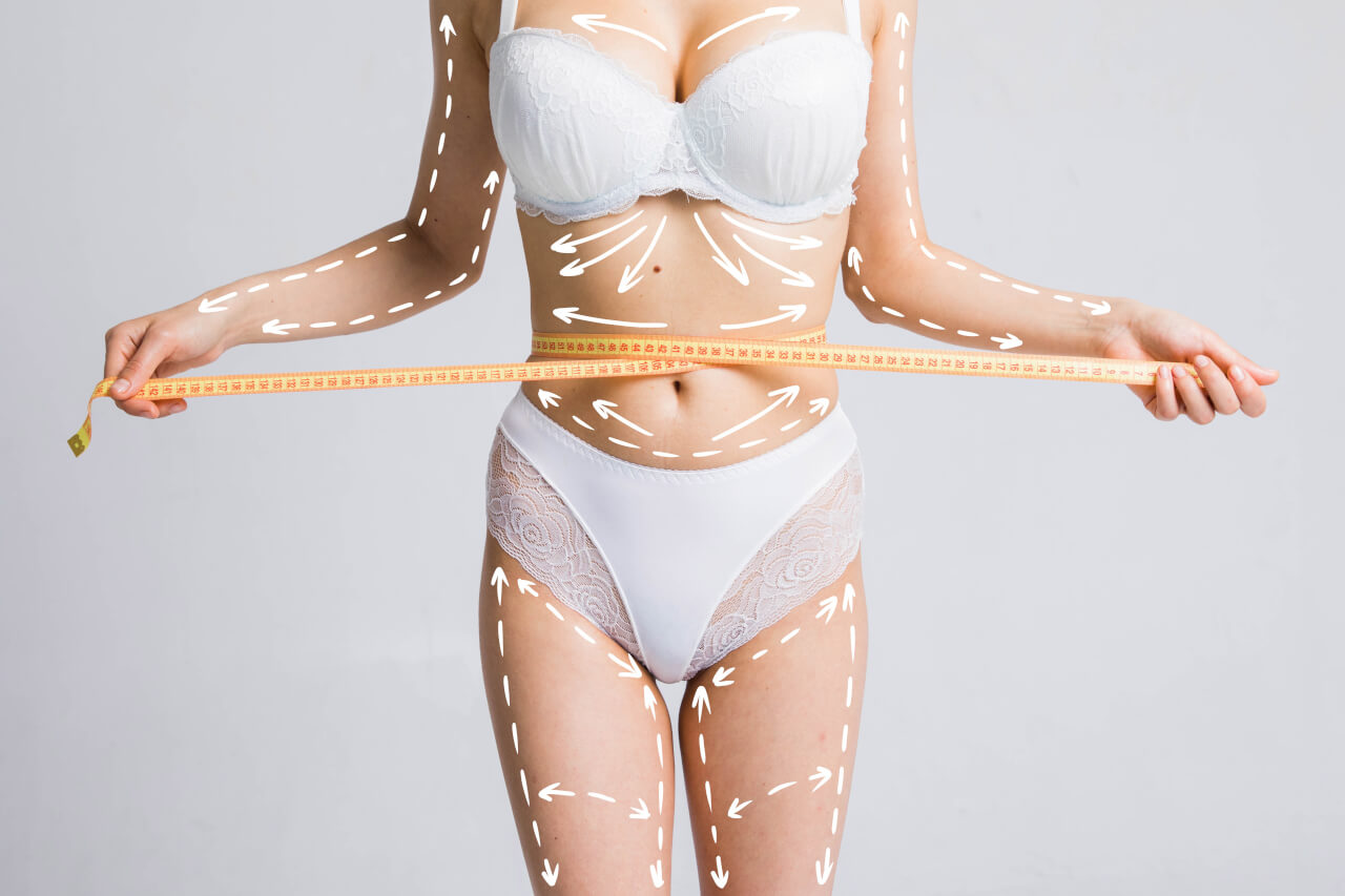 Laser assisted liposuction