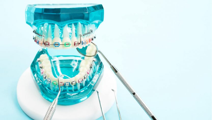 orthodontic care