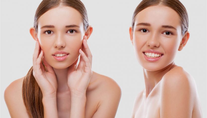 What Is Ear Plastic Surgery Benefits Of Otoplasty